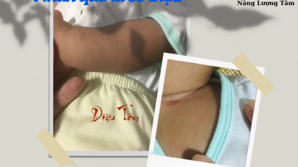 CHĂM SÓC SỨC KHỎE CỘNG ĐỒNG